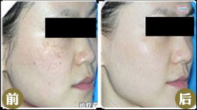 CF�����