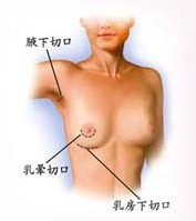 �ڿ���¡��