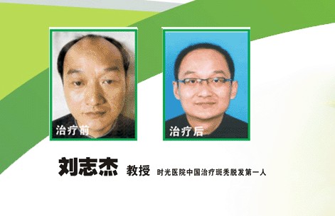 ��������΢�޺���ֲ����