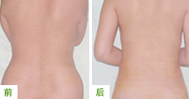 360ˮ������֬