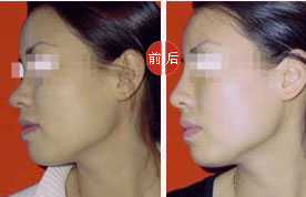 ���ۺ�����