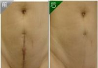 ����ָ�-�ʸ�����̺��޸�