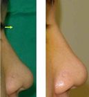 3D����¡��