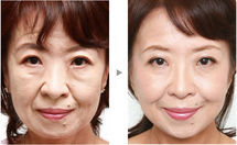 �������빦��-������