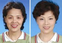 CRP�������