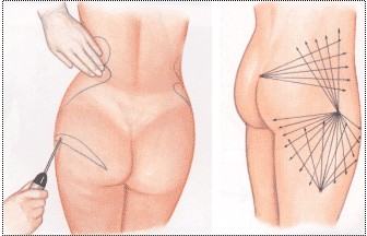 �β���֬��