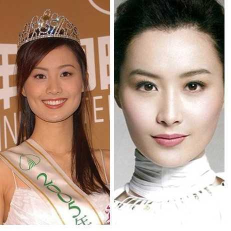 陈法拉也整容了?