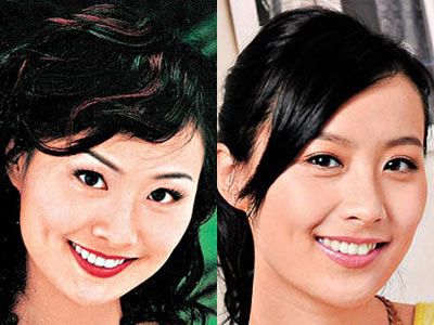 陈法拉也整容了?