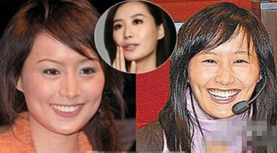 陈法拉也整容了?