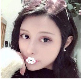 记录我的硅胶隆鼻后的变化