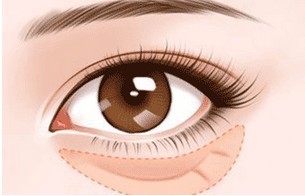 ֲ۴