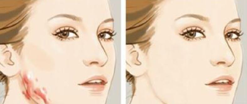 [ART_TITLE]