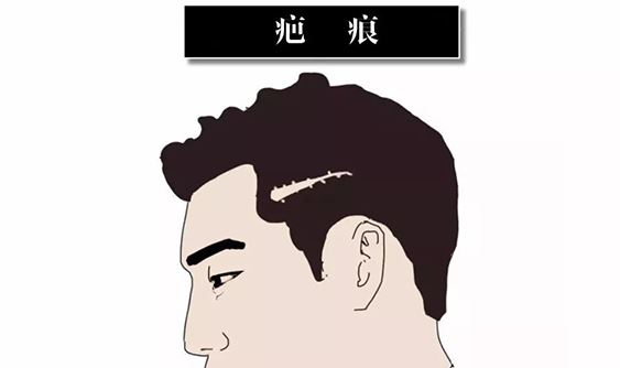 [ART_TITLE]