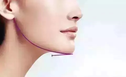 ӵкÿ° ʵɵõ