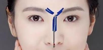 ǲ΢ߵ Ͼ