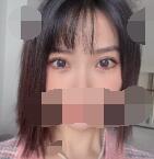 ˫ƤĺýԼʱ ֪˫Ƥôж
